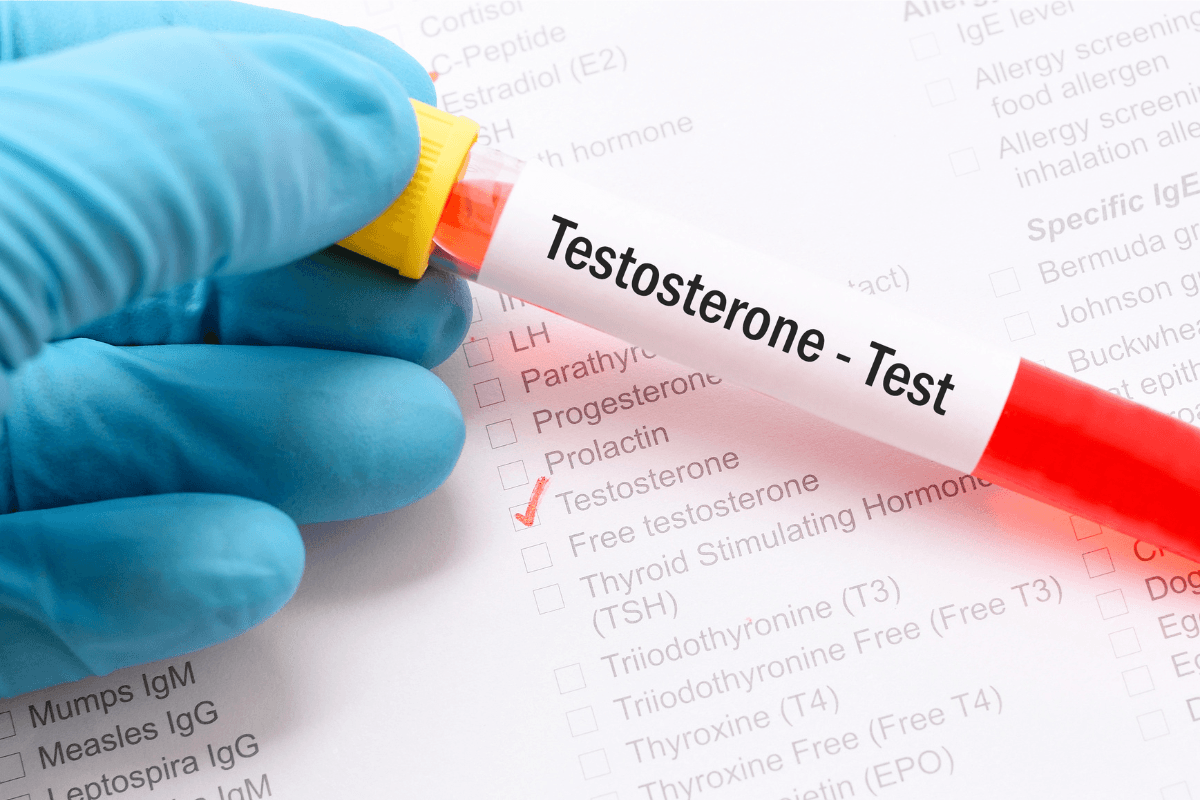 How Do Testosterone Test Results Reflect Hormonal Health and Metabolic Function?